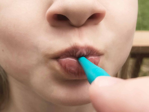 proButton - pour fermeture des lèvres/épaisseur (set de 2)